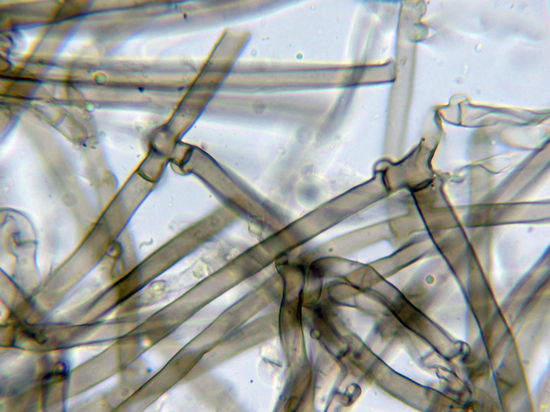 Microscopía de Tomentella muricata - 10 - Hifas subiculares KOH-001